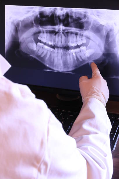 Best Emergency Tooth Extraction in Willmar, MN