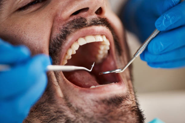 Best Emergency Dental Care for Broken or Chipped Teeth in Willmar, MN